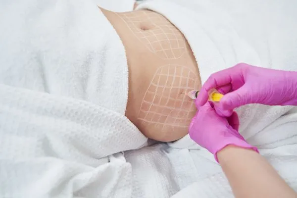 image of fat dissolving injections on love handles to help combat weight gain Hucknall under Huthwaite
