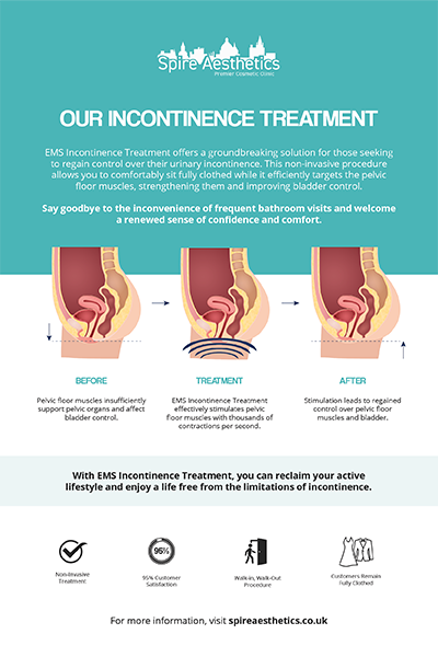 image to show how EMS treatment works for female urinary incontinence Hucknall under Huthwaite