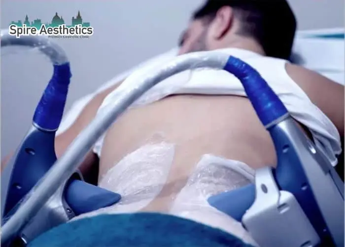 Man having fat freezing treatment done on love handles before a competitions Hucknall under Huthwaite to create a sculpted look.