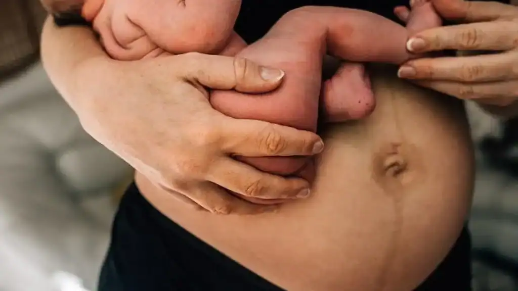 Why Is My Stomach Still Big After Pregnancy Hucknall under Huthwaite?